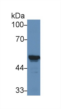 14912