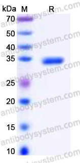 YHP02801, SDS-PAGE