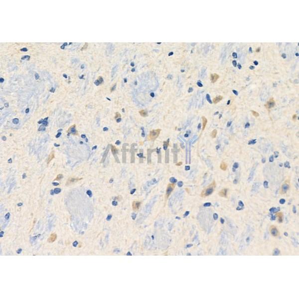 Валидация Affinity DF10201 - 5756