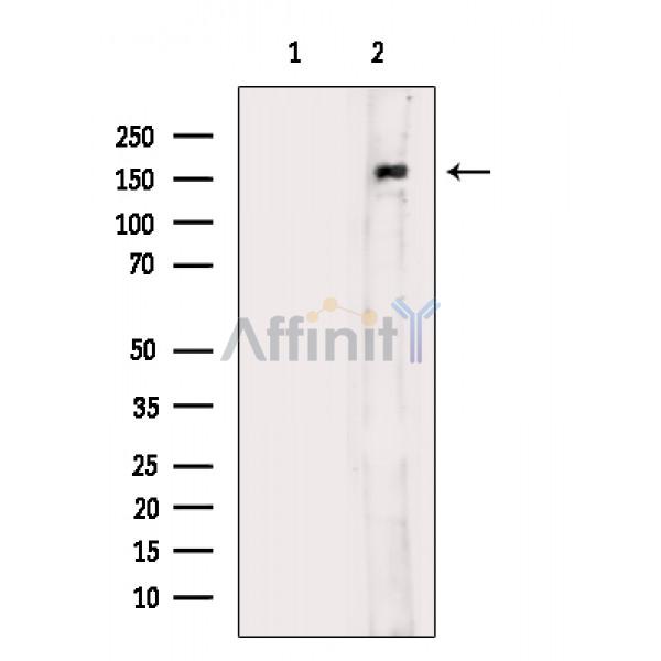 Валидация Affinity AF6128 - 3346