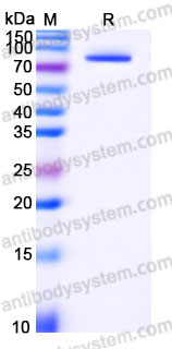 EHH00902, SDS-PAGE