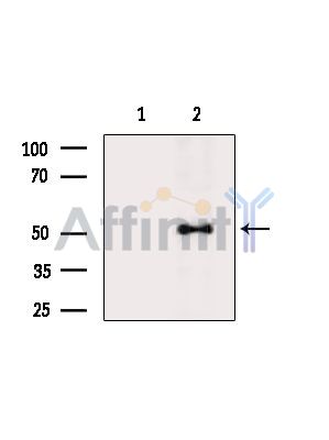 Валидация Affinity DF14098 - 9890