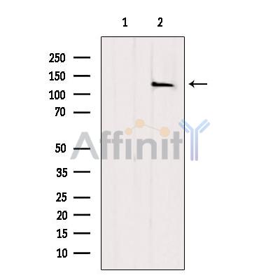Валидация Affinity AF9223 - 5063