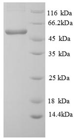 SDS-PAGE