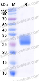 EHJ53505, SDS-PAGE