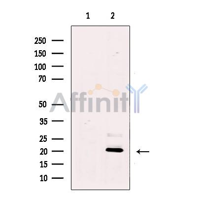 Валидация Affinity DF12062 - 6123