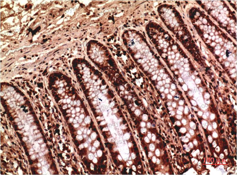 Валидация AntibodySystem RHD56205