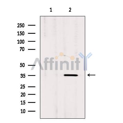 Валидация Affinity DF2857 - 13621
