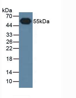 61418