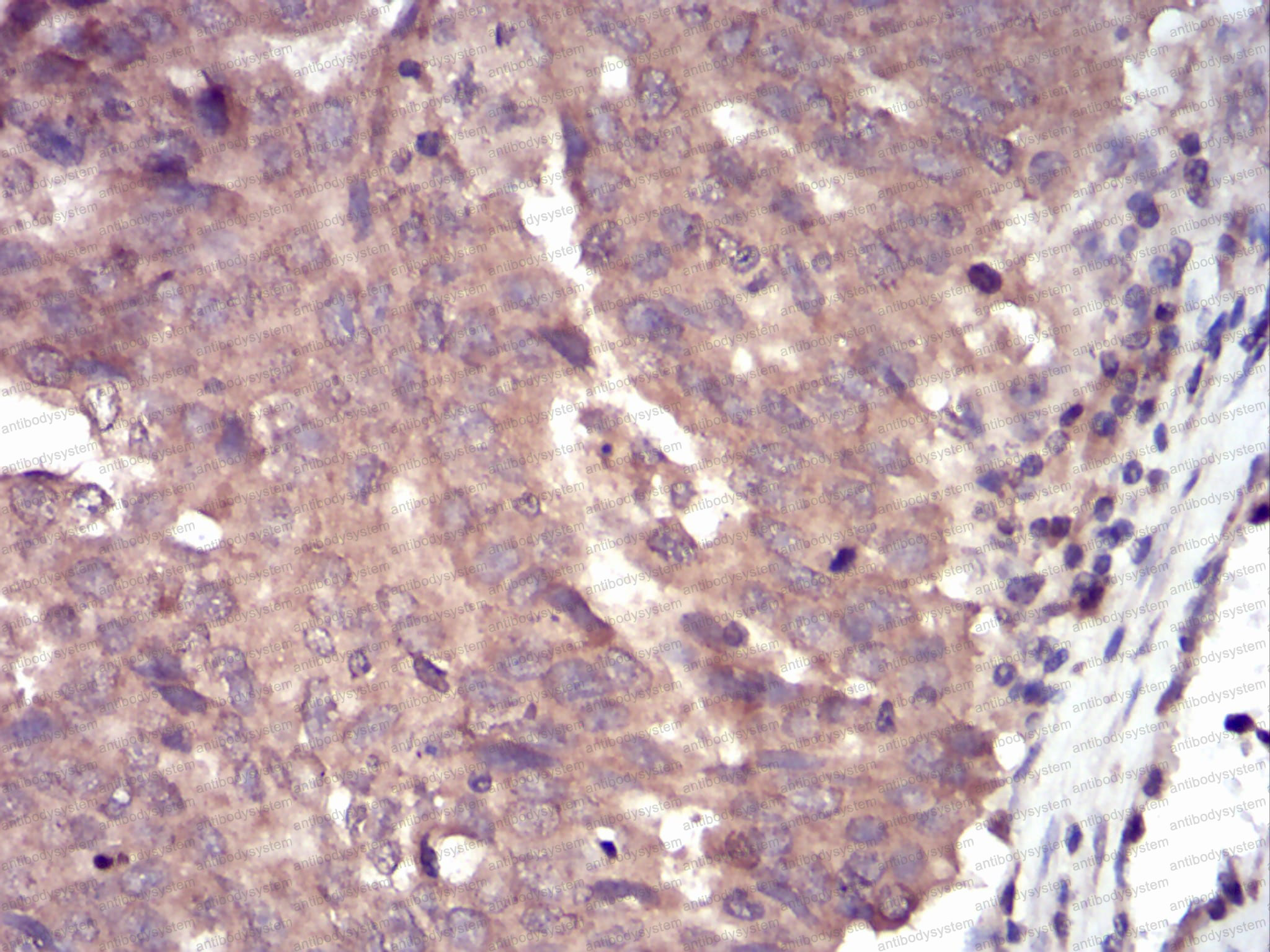 Валидация AntibodySystem RHN94301