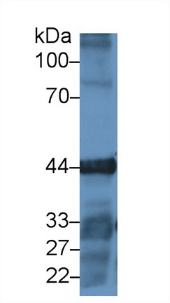 15264