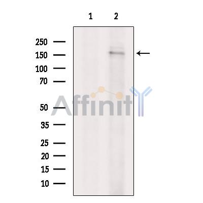 Валидация Affinity DF7160 - 18809