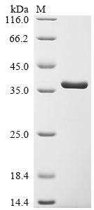 SDS-PAGE