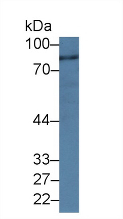 14378