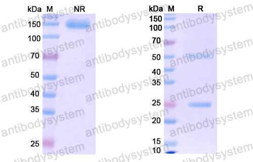 Валидация SDS-PAGE - AntibodySystem DHJ32901