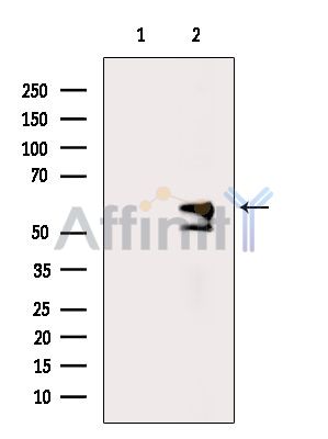 Валидация Affinity DF15868 - 12380