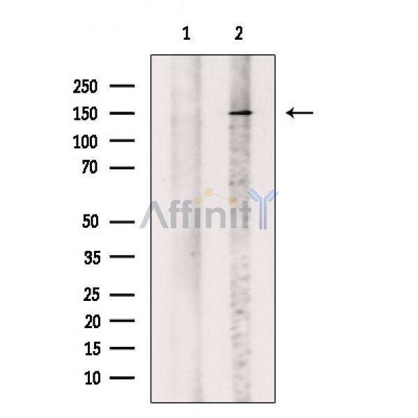 Валидация Affinity DF2648 - 13340