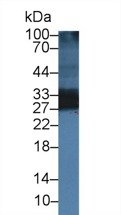 14313