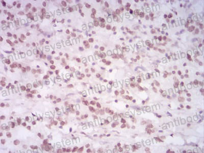 Валидация AntibodySystem RHF53205