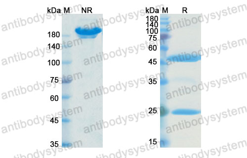 Валидация SDS-PAGE - AntibodySystem DHB10202