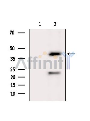 Валидация Affinity DF6886 - 18476