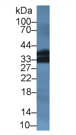 14448