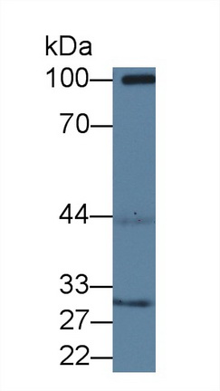 12651