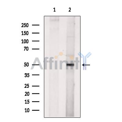 Валидация Affinity DF13588 - 9064