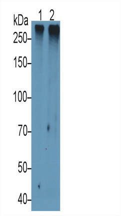 15555