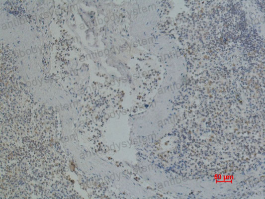 Валидация AntibodySystem RHC33303