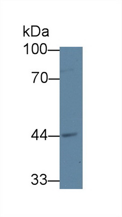 12614