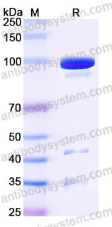 AHD72502, SDS-PAGE