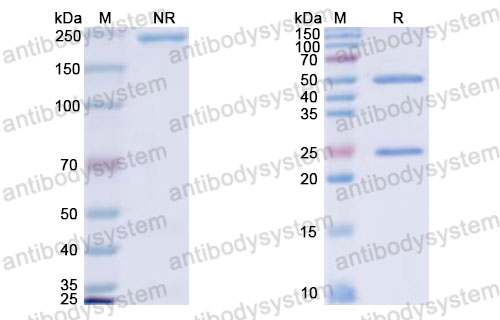 Валидация SDS-PAGE - AntibodySystem DHJ28414