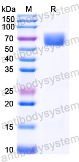 AHC31203, SDS-PAGE