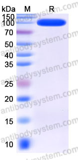 EHC98502, SDS-PAGE