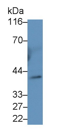 65027