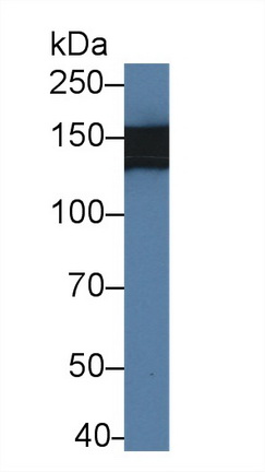 14303