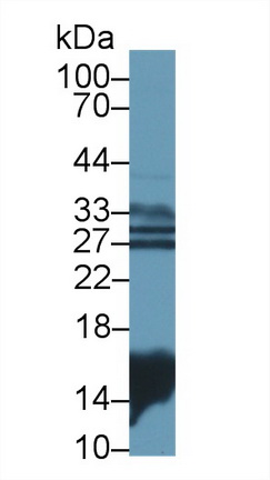 14536