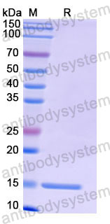 Валидация SDS-PAGE - AntibodySystem RHF66401