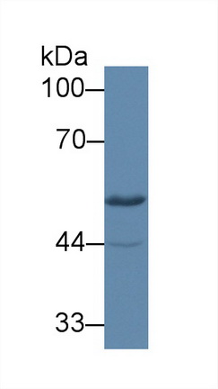 12700