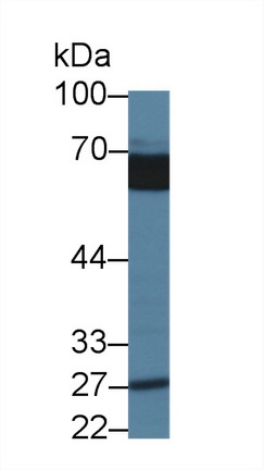 14395