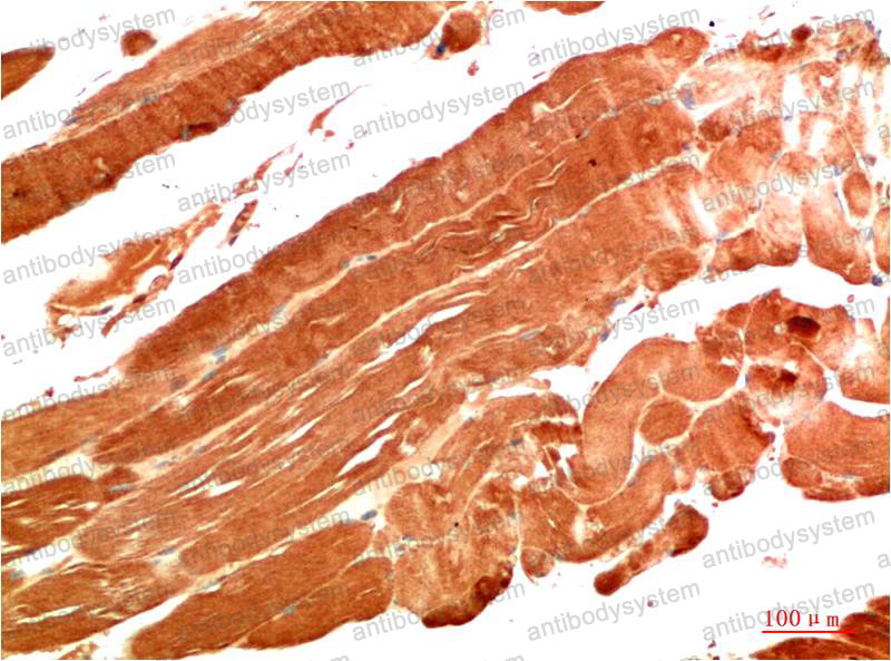 Валидация AntibodySystem RHG84501
