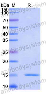 Валидация SDS-PAGE - AntibodySystem RVV30601