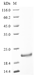 SDS-PAGE