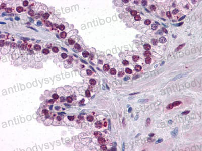 Валидация AntibodySystem RHC80302 (1072)
