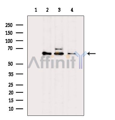 Валидация Affinity DF3515 - 14442