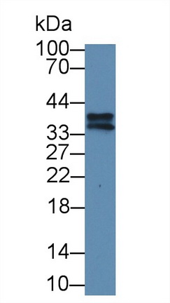 17631