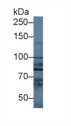 12485