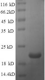 SDS-PAGE
