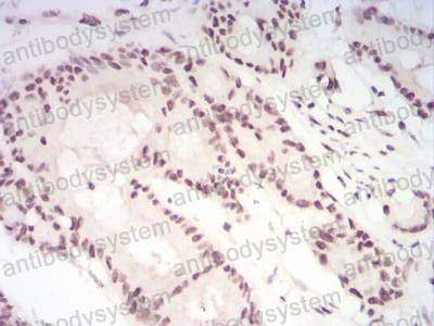Валидация AntibodySystem RHF75404
